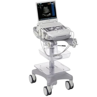 Used Siemens Acuson P300 Ultrasound