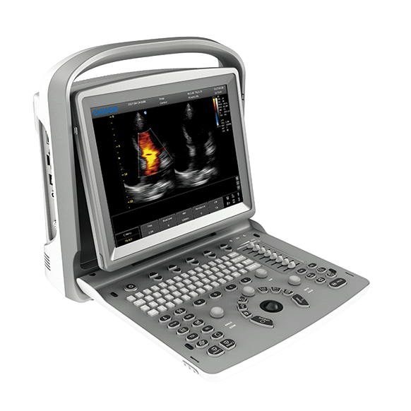 Chison ECO 6 Ultrasound Machine