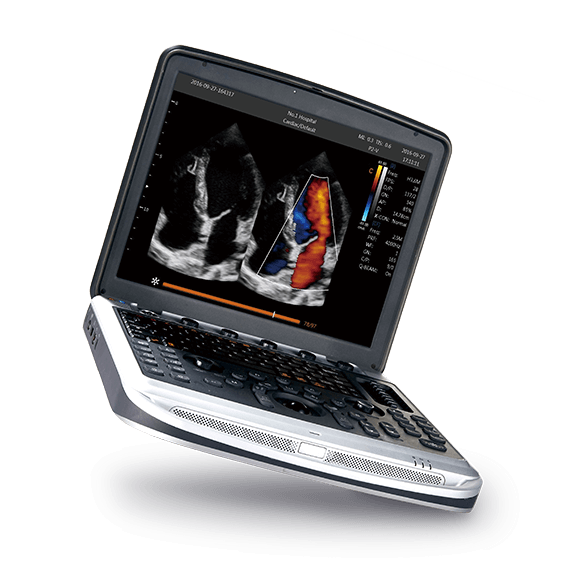 chison sonobook 8 ultrasound machine