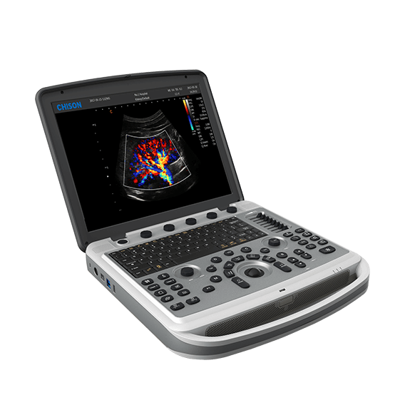 Chison SonoBook 6 ultrasound machine