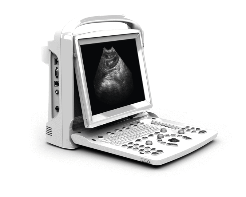 Chison ECO ultrasound machine